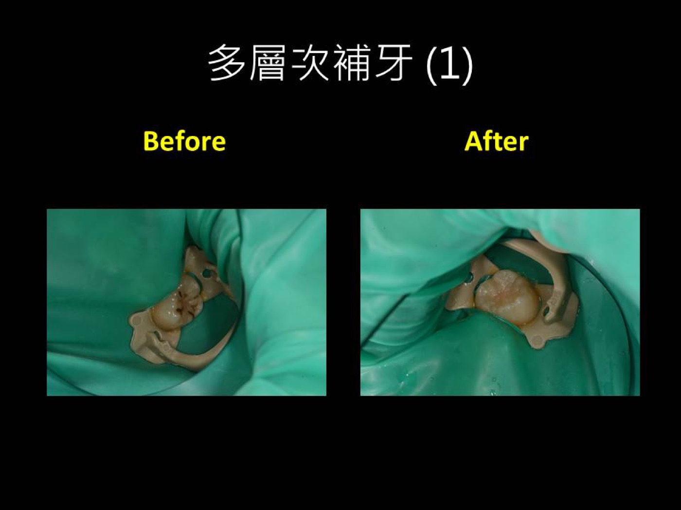 復形治療案例圖例 3