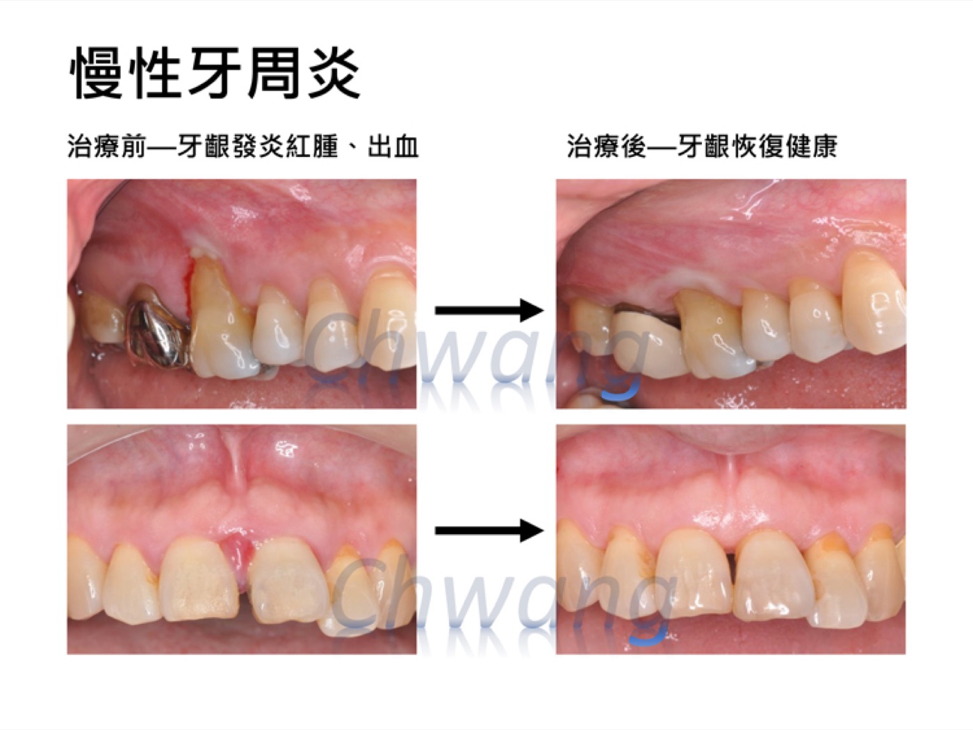 牙周健康與日常維護主圖